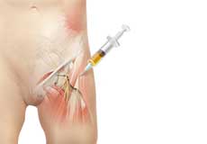 Platelet-Rich Plasma (PRP) Injection