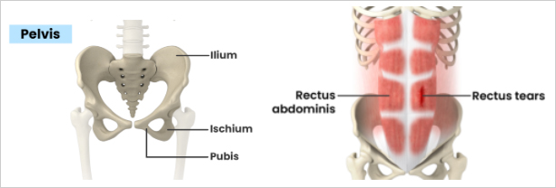 Hip Groin image