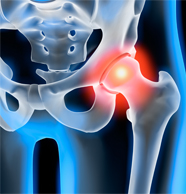 Signs You Might Have a Labral Tear of the Hip